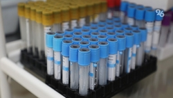 Минсельхоз Ставрополья приобретёт безопасные химикаты для борьбы с грызунами