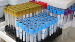 Дни донора пройдут в Невинномысске 3 и 6 февраля 