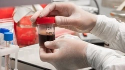 Главврач ставропольского центра СПИД рассказал о способах заражения ВИЧ-инфекцией
